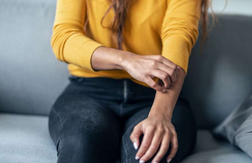 Comment faire partir l’eczéma rapidement ? Comment faire partir l'eczéma rapidement ?